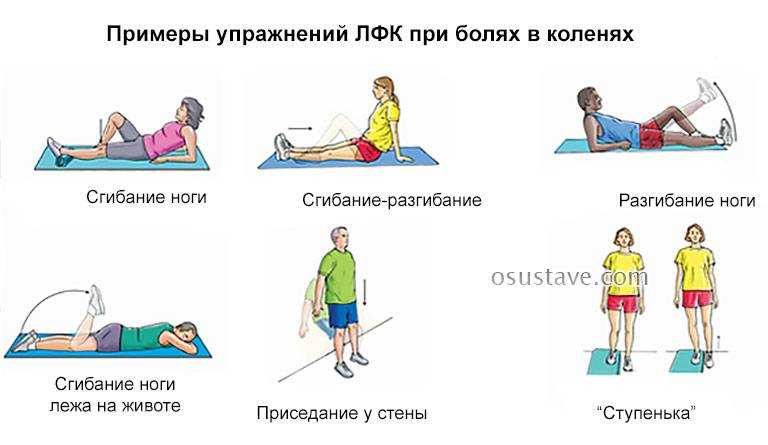 Упражнения для коленей при болях. Упражнентяпри больных колегя. Комплекс упражнений для коленного сустава. Упражнения при болях в коленях. Занятия при больных коленях.