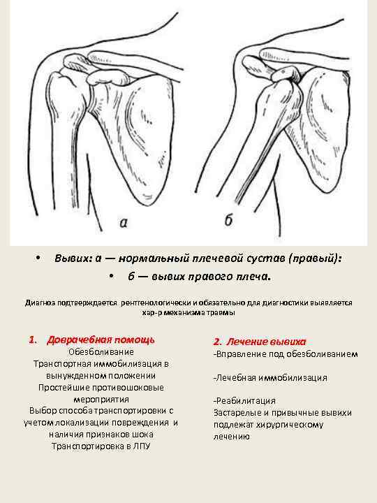 Ушиб плечевого сустава карта вызова