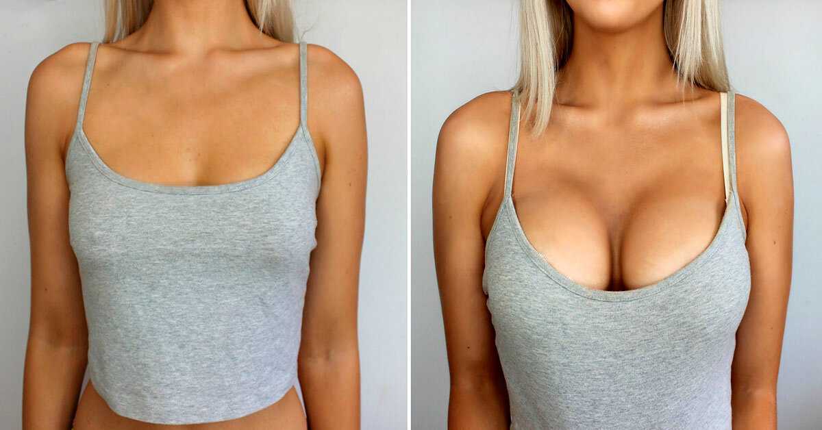 15 вещей, которые, на самом деле, могут увеличить (или уменьшить) размер груди